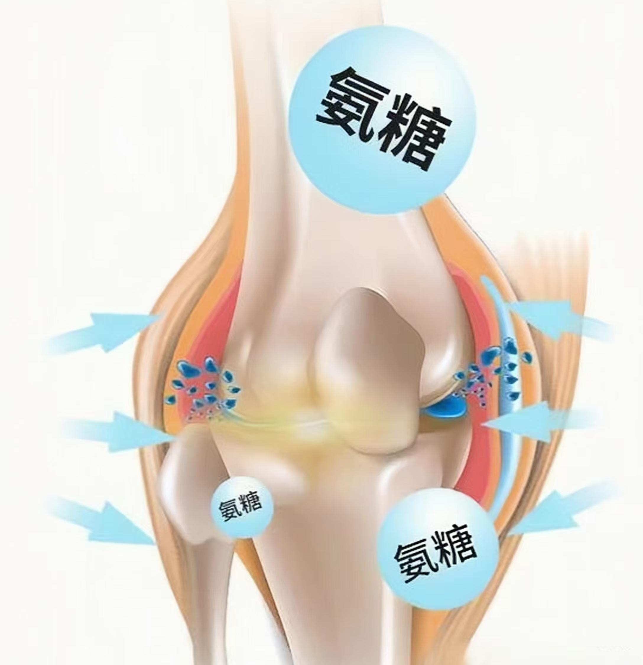 氨糖適合什么樣的人群補(bǔ)充？