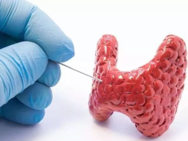 甲狀腺是怎么回事？健康生活這樣做