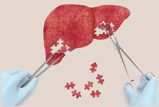拯救不良肝臟，補充硒元素，真正預防肝病風險